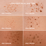 The Freckle Combo